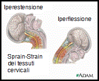 osteopatia-colpo-frusta